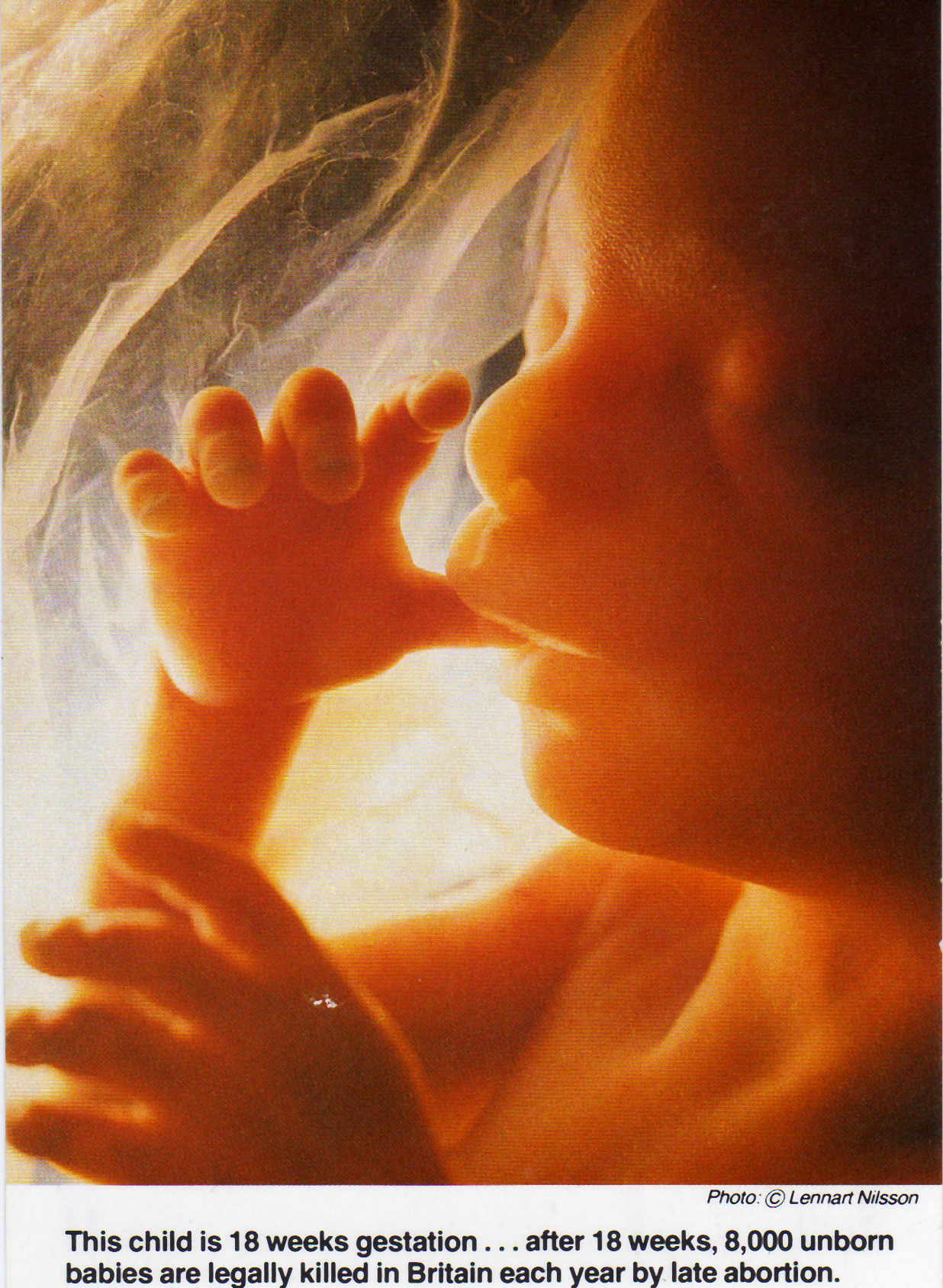 1987 The photographer, Lenart Neilson, gave permission for this picture of the unborn baby at 18 weeks to be used for the Alton Bill campaign. 1 million were printed-1